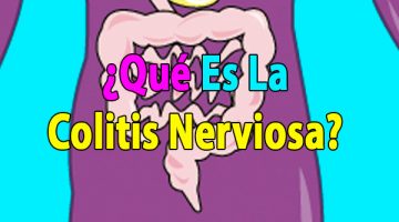 ¿Qué es la colitis nerviosa?